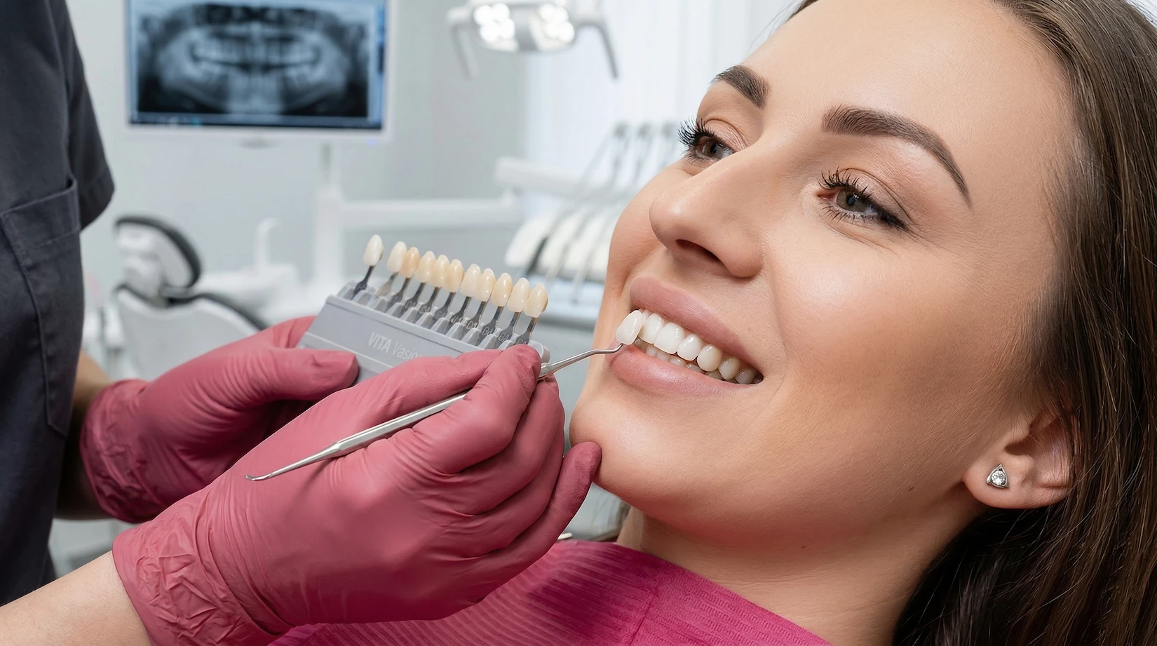 Люмініри: естетичне відновлення посмішки